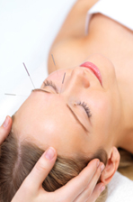 Woman receiving facial acupuncture therapy